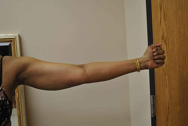 arm life after
