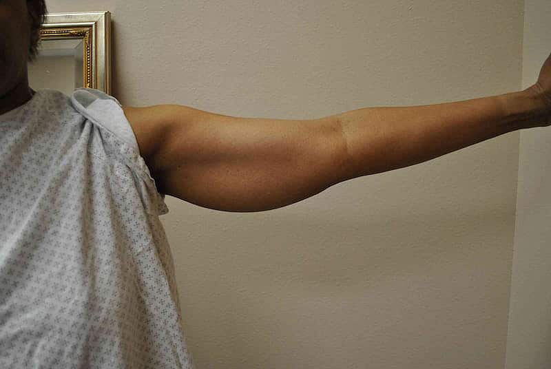 arm life before