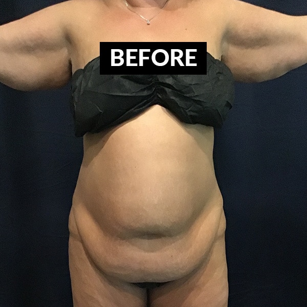 before tickletuck